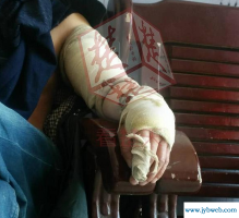 女人梦到被蛇咬(女人梦到被蛇咬到右脚)