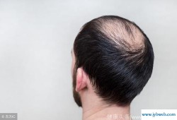 梦见把头发剪了(梦见把头发剪了周公解梦)