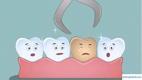 梦见拔牙(梦见拔牙齿 周公解梦)