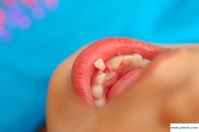 做梦梦见掉牙(做梦梦见掉牙没出血是什么意思)