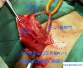 冯东川(冯东川博客)