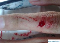 梦见耳朵流血(梦见耳朵流血是啥预兆)