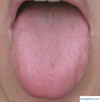 梦见舌头掉了(梦见舌头掉了又长出新的舌头)