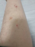 梦见被狗咬腿(梦见狗把腿咬了)