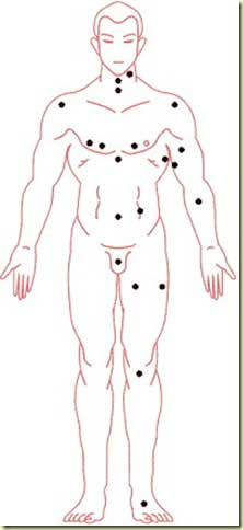 女人全身痣相图解(女人全身痣相图解真人全身痣相详解)