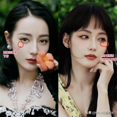 脸上的痣图解大全（ 面部痣相大全 ）