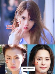 脸上的痣图解大全（ 面部痣相大全 ）