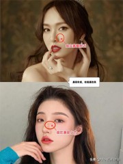 脸上的痣图解大全（ 面部痣相大全 ）