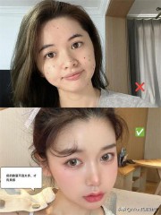 脸上的痣图解大全（ 面部痣相大全 ）