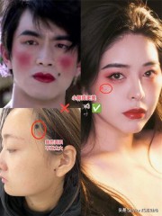 脸上的痣图解大全（ 面部痣相大全 ）