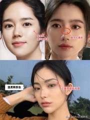 脸上的痣图解大全（ 面部痣相大全 ）