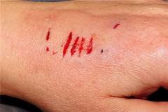 梦见狗咬手指什么预兆（女人梦见狗咬手指头是吉兆）